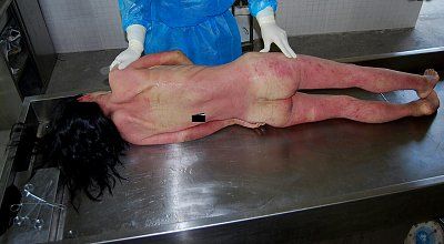 female-autopsy-2-2-1.jpg