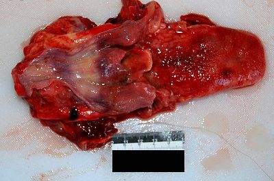 female-autopsy-2-18-1.jpg