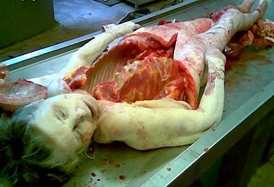 autopsy-woman.jpg