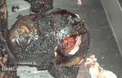 autopsy-burnt-child-02.jpg