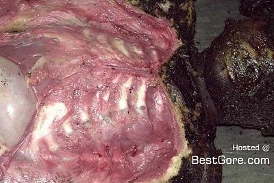 autopsy-burnt-child-03.jpg