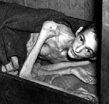 Young survivor of Bergen-Belsen.gif