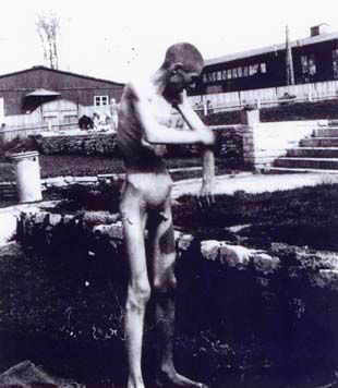Buchenwald Concentration Camp Liberation Photos Near Weimar, Germany, 1945 - Emaciated survivor of Buchenwald