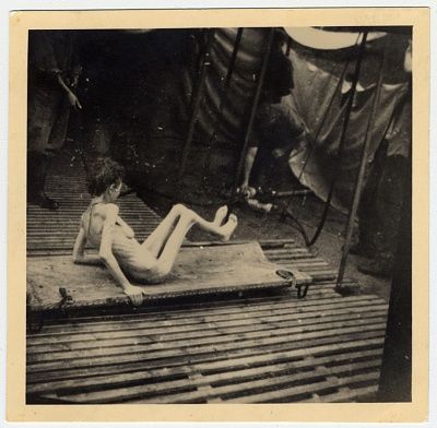 emaciated-survivor-sits-stretcher-bergen-belsen.jpg