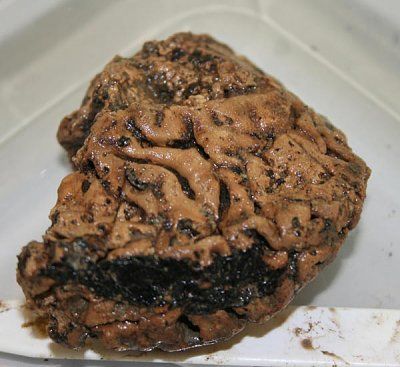 heslington-brain-sized.jpg