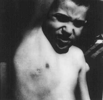 A Jewish child is forced to show the scar left after SS physicians removed his lymph nodes.jpg