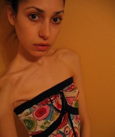 Anorexia10.jpg