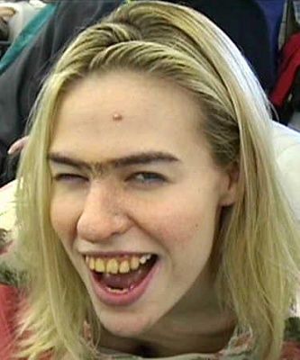 big-ugly-teeth-smile.jpg