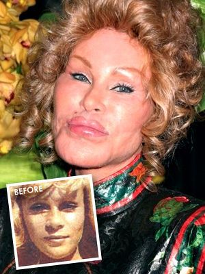 bad-plastic-surgery_Jocelyn-Wildenstein.jpg