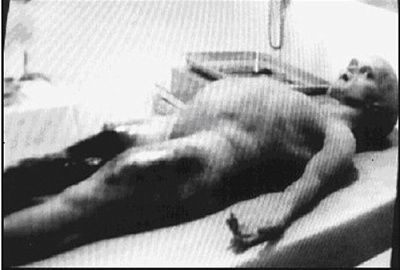 michael-jackson-autopsy.jpg