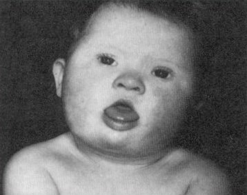 downplaatje.gif