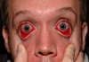 Redize's Avatar